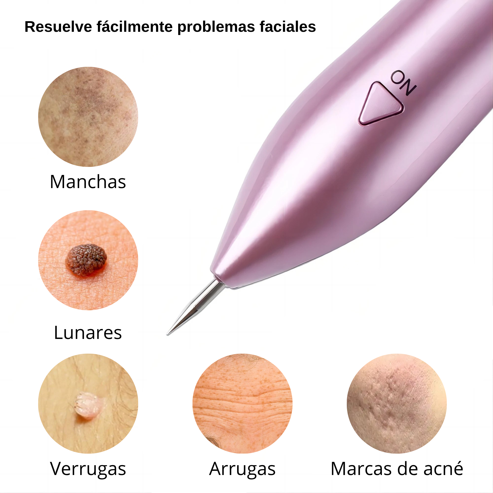 removedor de manchas, lunares, verrugas, arrugas y marcas de acné, tratamiento en casa fácil y seguro